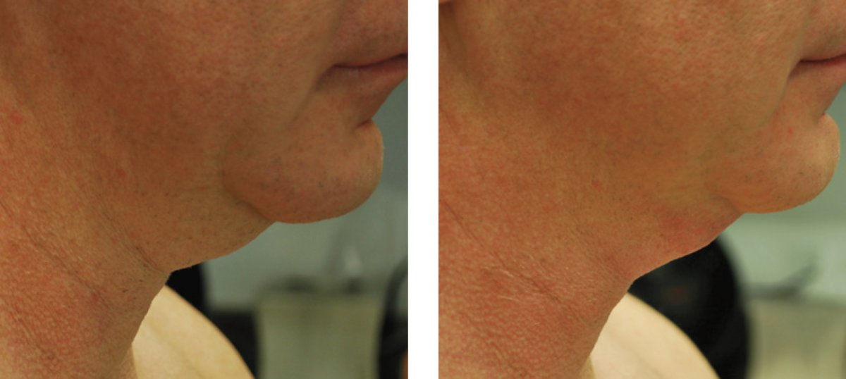 Mini Fx Body FX & Mini FX - Plastic Surgery & Orthopaedics | Richmond, VA