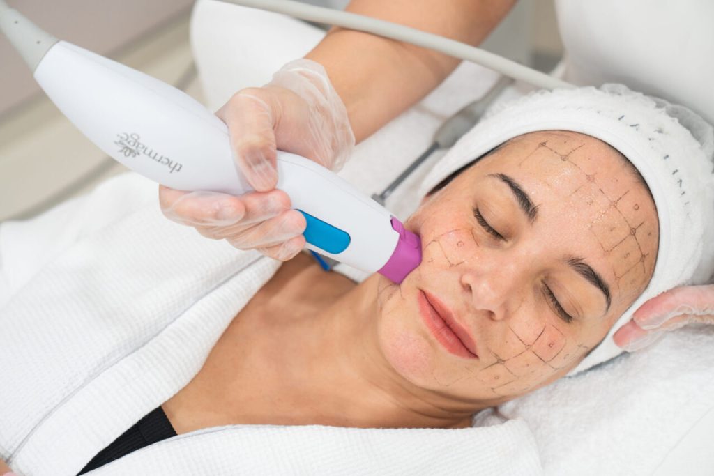 Thermage Treatments in Richmond, VA