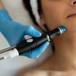 What is Microdermabrasion?